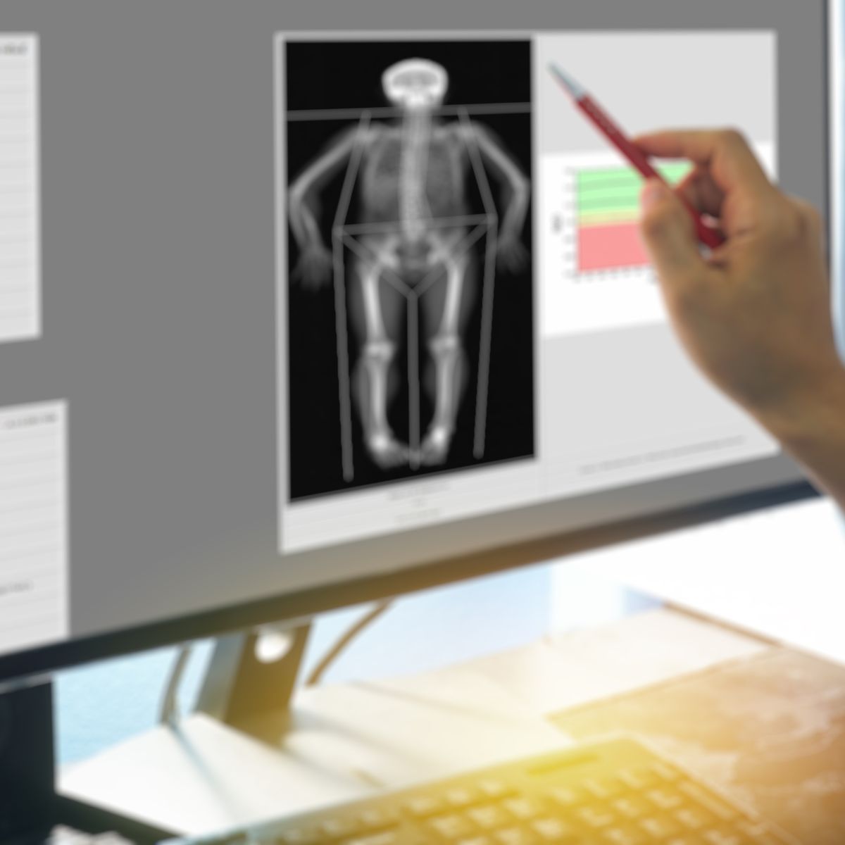 Densytometria Gniezno